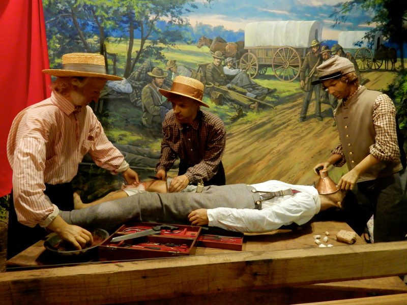 Field Surgery, National Museum of Civil War Medicine, Frederick MD